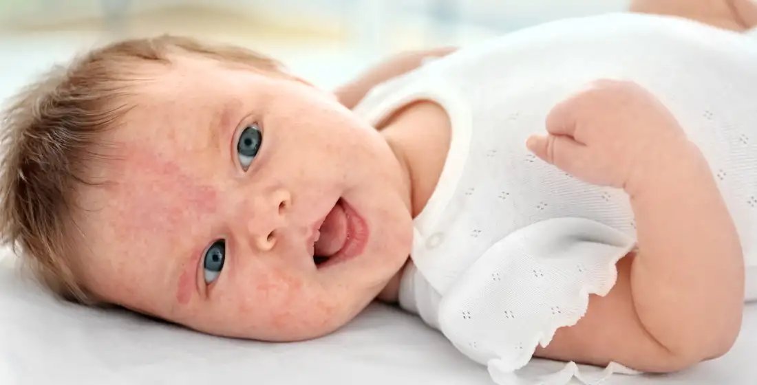 Babyhuid verzorgen