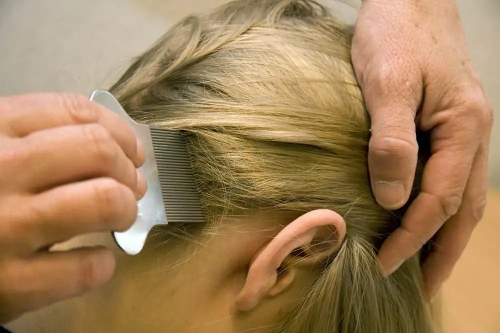 In 6 stappen je haren luisvrij